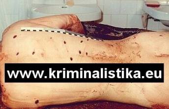 The stab wounds on the victim's body
